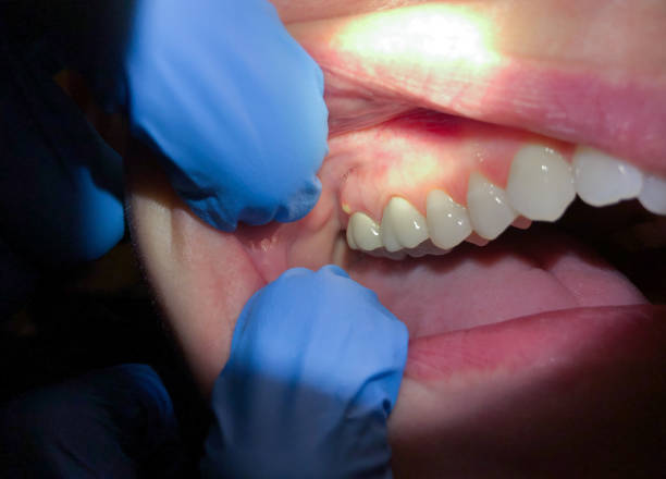 Best Pediatric Emergency Dentist in Northwoods, MO