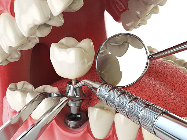 Best Emergency Dental Care for Trauma or Injury in Northwoods, MO